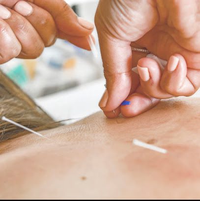 Jessica Bugra Acupuncture | Registered Acupuncturist & Holistic Life Coach